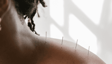 Image for 45 Min Acupuncture
