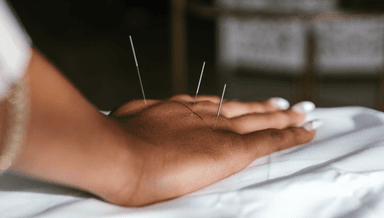 Image for First Acupuncture Visit (New patient or those not seen for over 2 years)
